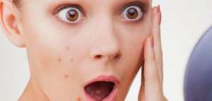 ما أفضل علاج لحب الشباب