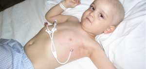 سرطان الدم عند الأطفال