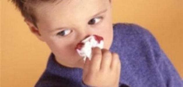 ما علاج نزيف الأنف