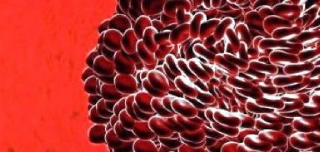 ما هو سبب تخثر الدم