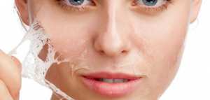 كيف أتخلص نهائياً من حب الشباب