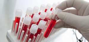 الأضرار الناتجة عن زيادة مستوى الفسفور في الدم