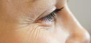 علاج سريع لتجاعيد تحت العين