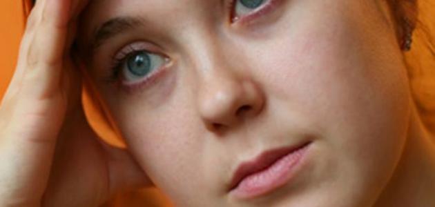 إزالة الهالات السوداء تحت العين نهائياً