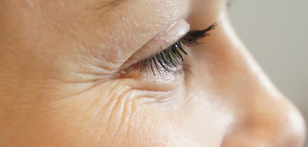 علاج سريع لتجاعيد تحت العين