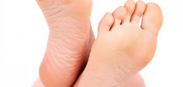 طرق لعلاج تشقق القدمين