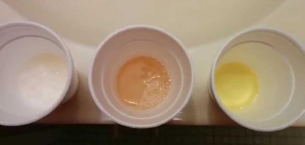 طريقة الكشف عن الحمل في المنزل