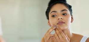 سبب ظهور حب الشباب على الوجه