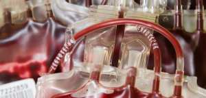 أسباب فقر الدم بعوز الحديد