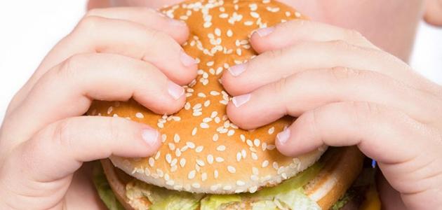 أسباب السمنة