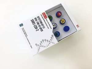 جامعة بلعباس تنتج كواشف الكورونا