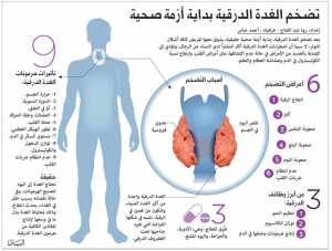 علاج نهائى للغدة الدرقية :