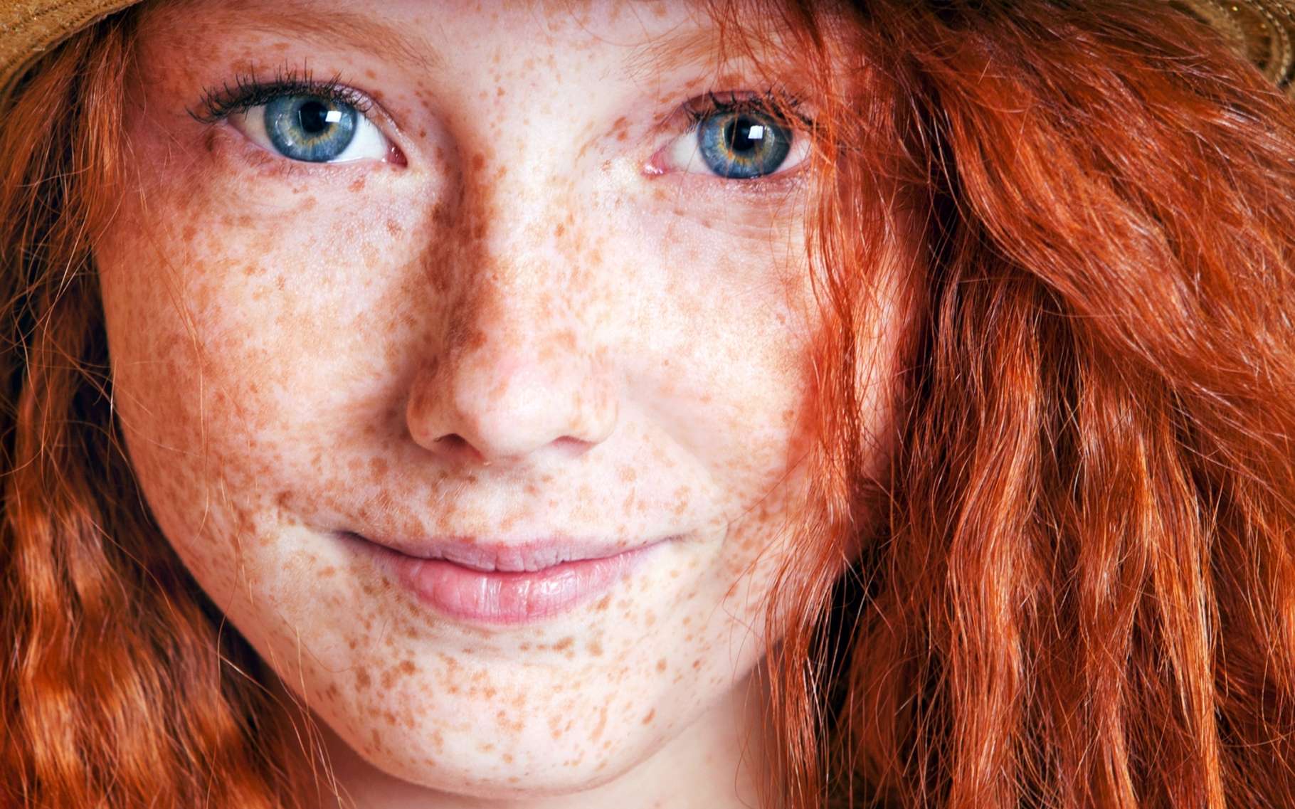 Pourquoi les roux ressentent-ils la douleur différemment ?