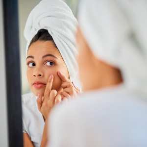 Les points noirs : à quoi sont-ils dus ?