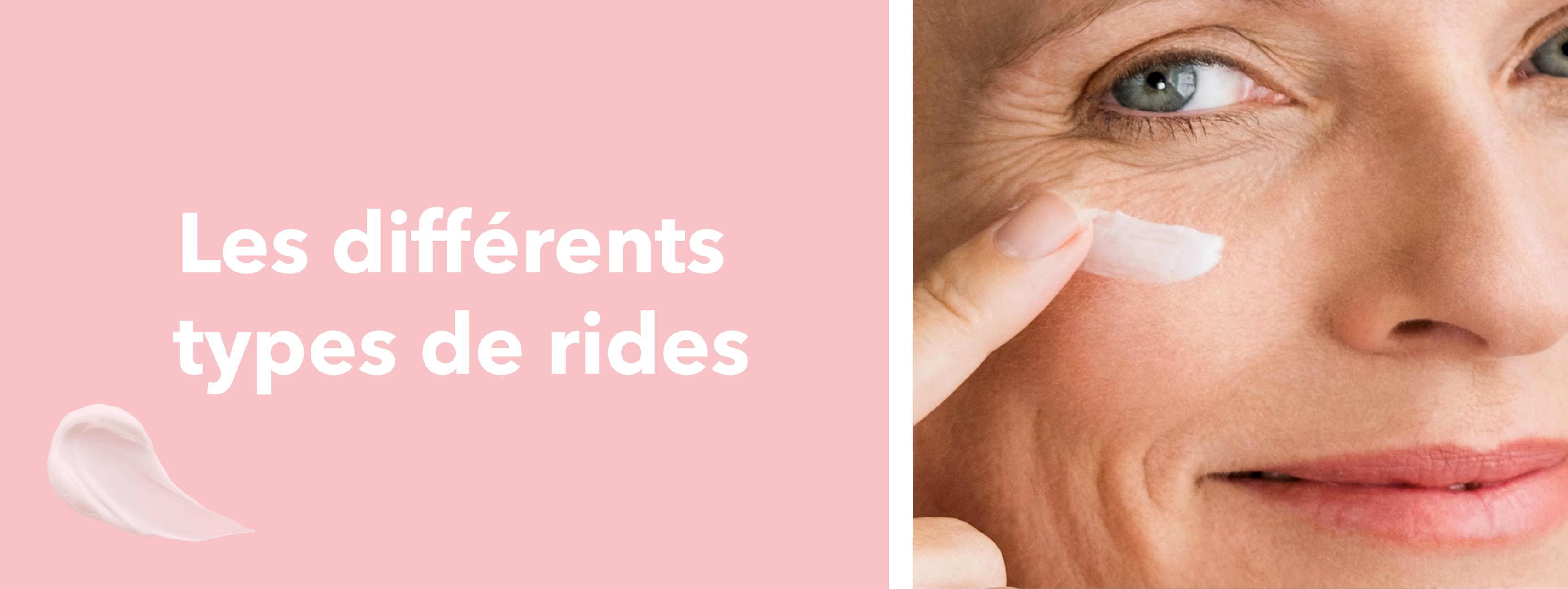 Les différents types de rides