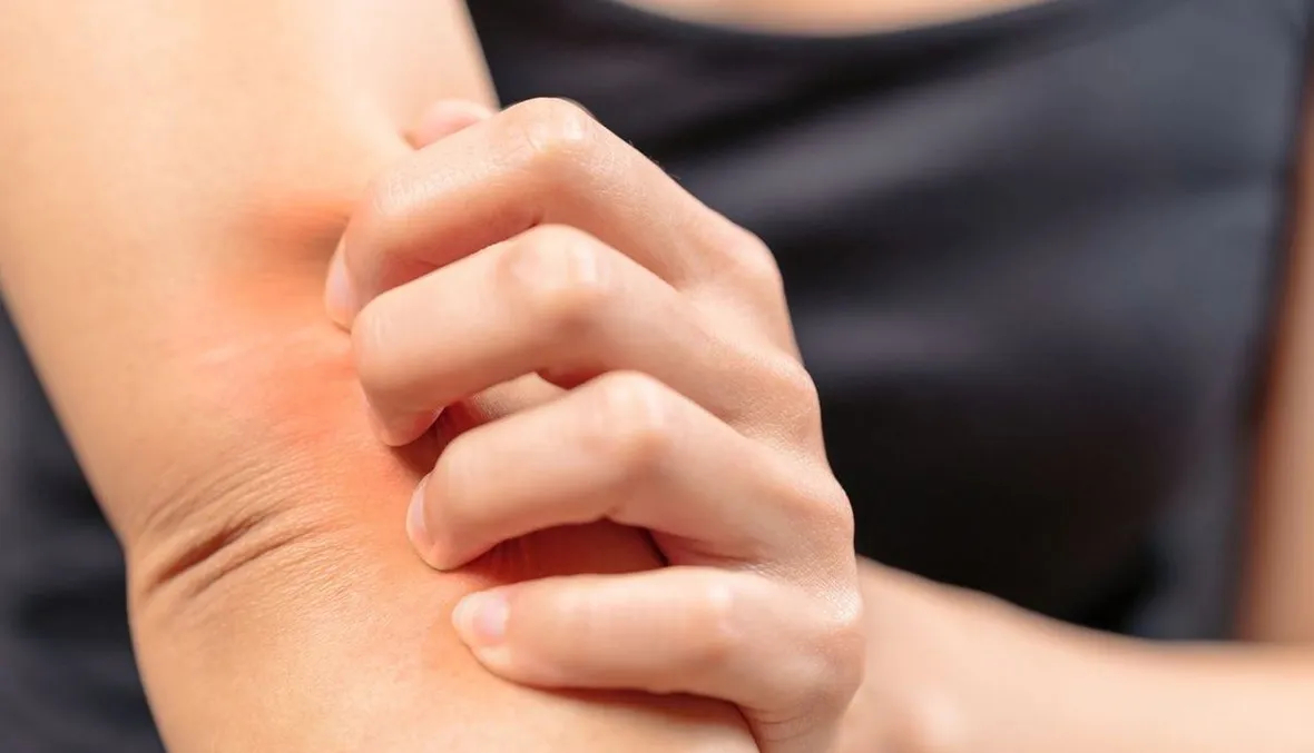 Le Pr Djenouhat appelle à l'inclusion des vaccins antiallergiques dans le calendrier vaccinal