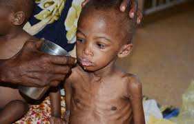 Planète - La faim ne recule pas et touche près de 10 % de la population mondiale