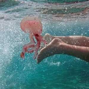 comment apaiser Les piqûres de méduses?🐙🪼 🚨كيفية تهدئة لسعات قنديل البحر