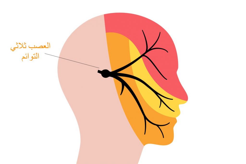 تكوين حول علاج الألم العصبي الثلاثي التوائم في مستشفى وهران - الشعب أونلاين