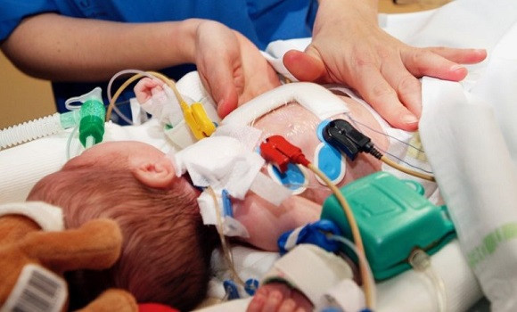 Journée Internationale sur la réanimation pédiatrique à Oran