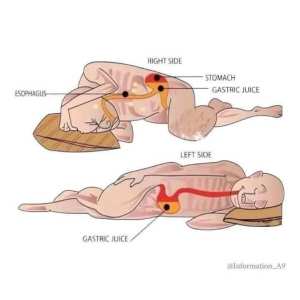 الإعجاز العلمي في النوم على الشق الأيمن