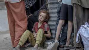 أنين الجوع في غزّة يتصاعد