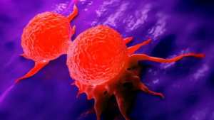 اختراق هام في العلاج .. اكتشاف مفتاح رئيسي لمنع تطور وانتشار سرطان الثدي