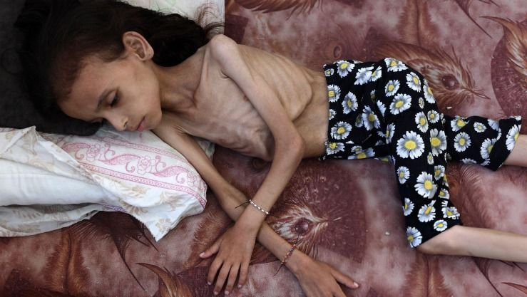 تآكل جسدها وذبلت ملامحها.. مريم دواّس غزية تنهكها المجاعة بصمت