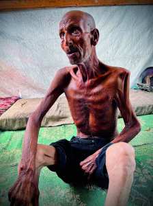 شاهد على مجاعة غزّة