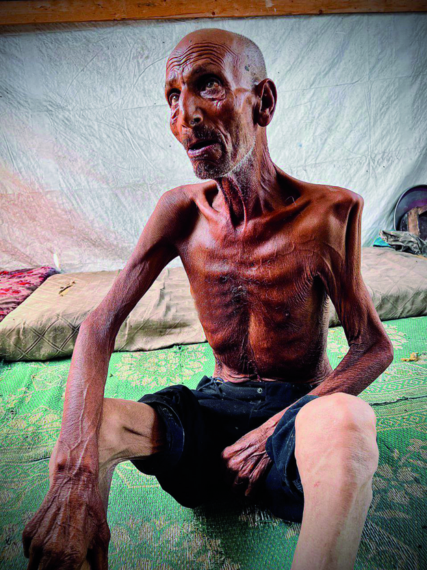 شاهد على مجاعة غزّة