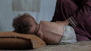 لا أكل ولا ماء.. والقصف لا يتوقّف