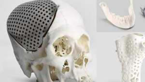 تحول ثوري في الطب التجميلي.. إطلاق  أول تجربة لزراعة أنسجة مطبوعة بتقنية ثلاثية الأبعاد