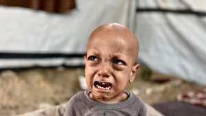 وفاة الطفل الغزاوي عبدالله أبو زرقة صاحب عبارة  أنا جعان