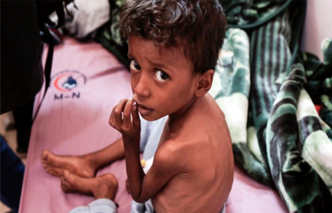 Les enfants continuent «de mourir  de faim»