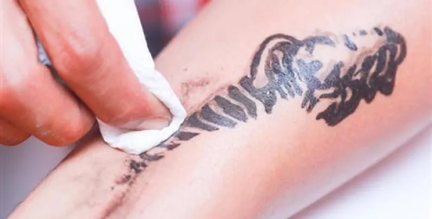 التاتواج  يغزو الشواطئ في الصيف