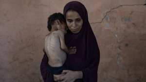 غزة.. 8 وفيات جديدة بسبب المجاعة وسوء التغذية بينهم طفلان خلال 24 ساعة