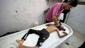 4 شهداء جراء الجوع وسوء التغذية في غزة وتحذيرات من موت جماعي