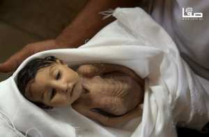 الجزائر تدين الإرهاب الصهيوني