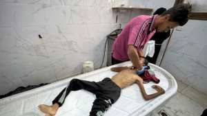 غزة.. 10 وفيات بينهم طفلان نتيجة المجاعة خلال الـ24 ساعة الماضية