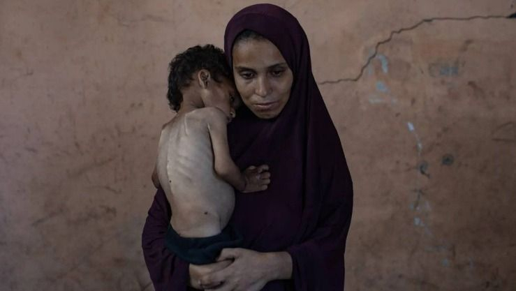 غزة.. 8 وفيات جديدة بسبب المجاعة وسوء التغذية بينهم طفلان خلال 24 ساعة