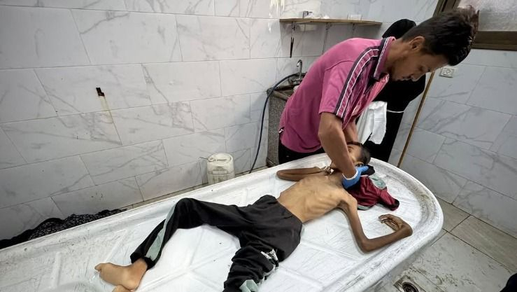 غزة.. 10 وفيات بينهم طفلان نتيجة المجاعة خلال الـ24 ساعة الماضية