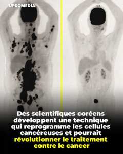 Des scientifique coréens du sud ;développent une technique qui reprogramme les cellules cancéreuses et pourrait révolutionner le traitement contre le cancer