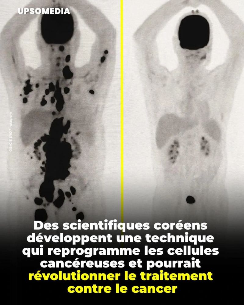 Des scientifique coréens du sud ;développent une technique qui reprogramme les cellules cancéreuses et pourrait révolutionner le traitement contre le cancer