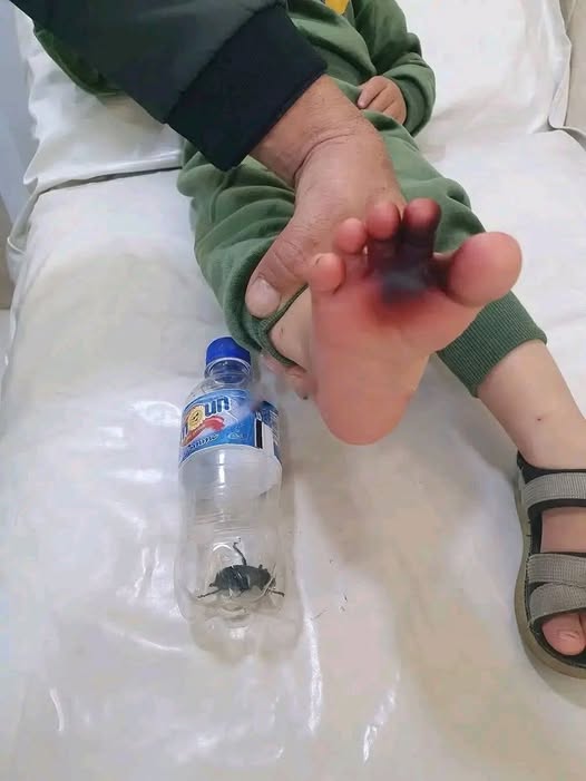 خدعة ذكية من خنفساء سوداء ترعب أباً وطاقماً طبياً في قسم الإسعافات