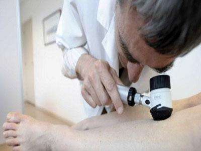 Incidence alarmante et prise en charge aléatoire                                    Cancer de la peau, l'autre «fardeau» de la santé publique