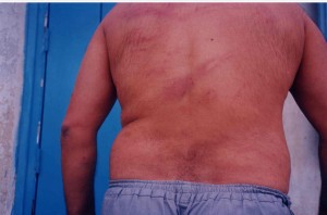 Par devoir moral envers ceux qui sont morts sous la torture.