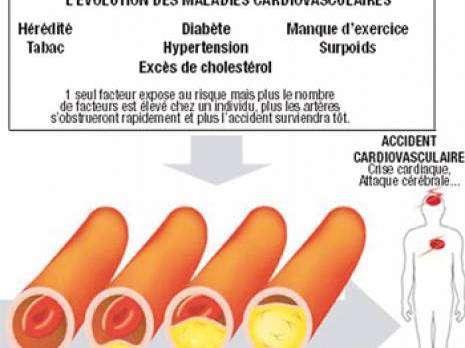 L'hypercholestérolémie, un facteur aggravant pour ces maladies                                    Maladies cardio-vasculaires provoque 40 000 décès par an en Algérie