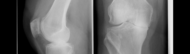 Medea - Orthopédie, Traumatologie, Rhumatologie