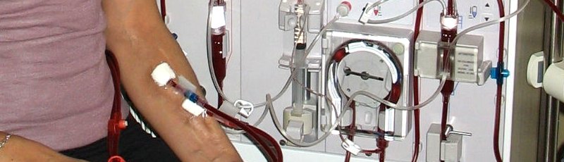 Ghardaia - Insuffisances rénales chroniques , Hémodialyse