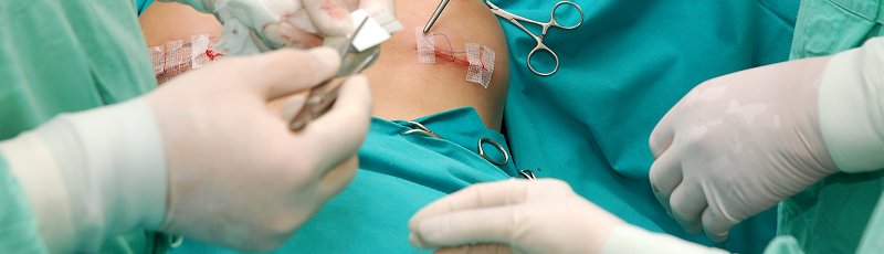 Tiaret - Chirurgie générale